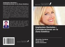 Couverture de Implantes Dentales : Consideraciones en la Zona Estética