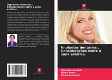 Portada del libro de Implantes dentários : Considerações sobre a zona estética