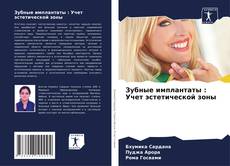 Portada del libro de Зубные имплантаты : Учет эстетической зоны