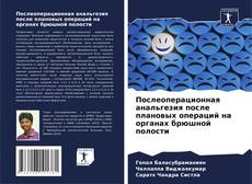 Borítókép a  Послеоперационная анальгезия после плановых операций на органах брюшной полости - hoz