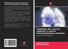 Couverture de Síndrome da caverna superior e cancro broncopulmonar primário