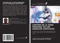 Portada del libro de LINFOMA DE LA ZONA MARGINAL DE LOS GANGLIOS LINFÁTICOS