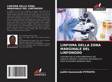 Portada del libro de LINFOMA DELLA ZONA MARGINALE DEL LINFONODO