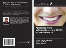 Portada del libro de Aplicación de la polieteretercetona (PEEK) en prostodoncia