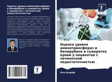 Borítókép a  Оценка уровня аминотрансфераз и билирубина в сыворотке крови у пациентов с печеночной недостаточностью - hoz