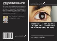 Portada del libro de Eficacia del tapón lagrimal Colagen en el tratamiento del síndrome del ojo seco