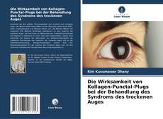 Bookcover of Die Wirksamkeit von Kollagen-Punctal-Plugs bei der Behandlung des Syndroms des trockenen Auges