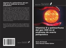 Capa do livro de Vitamina D y polimorfismo del gen VDR en el síndrome de ovario poliquístico 