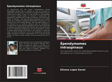 Couverture de Épendymomes intraspinaux