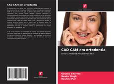 Couverture de CAD CAM em ortodontia