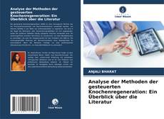 Обложка Analyse der Methoden der gesteuerten Knochenregeneration: Ein Überblick über die Literatur