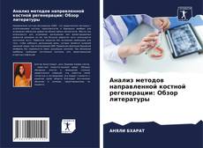 Portada del libro de Анализ методов направленной костной регенерации: Обзор литературы