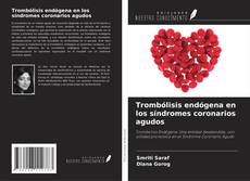 Couverture de Trombólisis endógena en los síndromes coronarios agudos