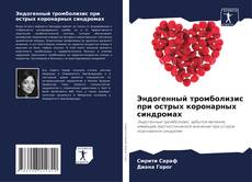 Portada del libro de Эндогенный тромболизис при острых коронарных синдромах