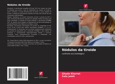 Couverture de Nódulos da tiroide