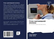 Portada del libro de Узлы щитовидной железы