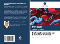 Portada del libro de Sichelzellenanämie bei Kindern in Marokko