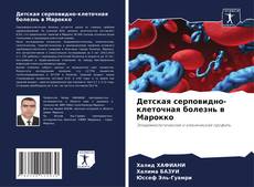 Portada del libro de Детская серповидно-клеточная болезнь в Марокко