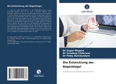 Bookcover of Die Entwicklung der Bogenbügel