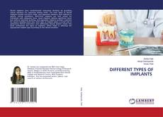 Copertina di DIFFERENT TYPES OF IMPLANTS