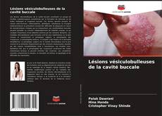 Bookcover of Lésions vésiculobulleuses de la cavité buccale