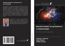 Bookcover of Nanotecnología en periodoncia e implantología