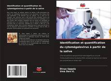 Couverture de Identification et quantification du cytomégalovirus à partir de la salive