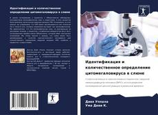 Bookcover of Идентификация и количественное определение цитомегаловируса в слюне