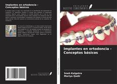 Buchcover von Implantes en ortodoncia - Conceptos básicos