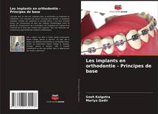 Обложка Les implants en orthodontie - Principes de base