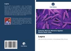 Bookcover of Lepra