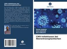 Borítókép a  CMV-Infektionen bei Nierentransplantierten - hoz