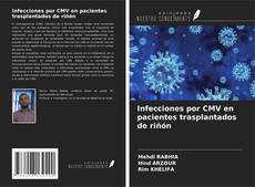 Couverture de Infecciones por CMV en pacientes trasplantados de riñón