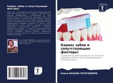 Bookcover of Кариес зубов и сопутствующие факторы: