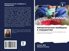 Bookcover of Амниотическая мембрана в эндодонтии