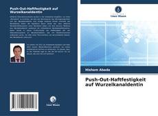 Couverture de Push-Out-Haftfestigkeit auf Wurzelkanaldentin