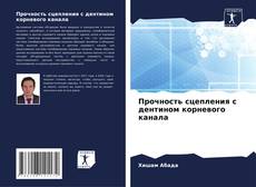 Прочность сцепления с дентином корневого канала的封面