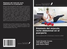 Copertina di Diástasis del músculo recto abdominal en el puerperio