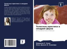 Buchcover von Телесные практики и синдром Дауна