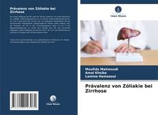 Couverture de Prävalenz von Zöliakie bei Zirrhose