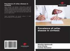 Buchcover von Prevalence of celiac disease in cirrhosis