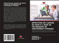 Borítókép a  DÉTECTION DU CANCER DU REIN À L'AIDE DE TECHNIQUES DE TRAITEMENT D'IMAGES - hoz