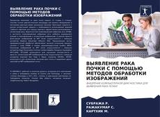 Borítókép a  ВЫЯВЛЕНИЕ РАКА ПОЧКИ С ПОМОЩЬЮ МЕТОДОВ ОБРАБОТКИ ИЗОБРАЖЕНИЙ - hoz