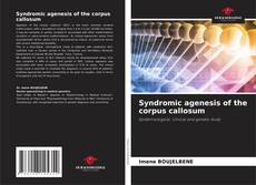 Syndromic agenesis of the corpus callosum的封面