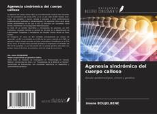 Capa do livro de Agenesia sindrómica del cuerpo calloso 