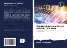 Borítókép a  Синдромальная агенезия мозолистого тела - hoz