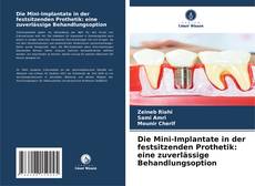 Capa do livro de Die Mini-Implantate in der festsitzenden Prothetik: eine zuverlässige Behandlungsoption 