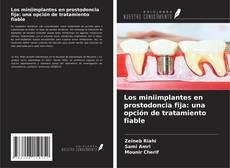 Buchcover von Los miniimplantes en prostodoncia fija: una opción de tratamiento fiable