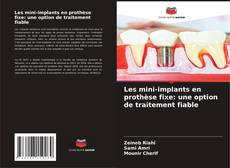 Copertina di Les mini-implants en prothèse fixe: une option de traitement fiable