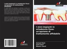 I mini-impianti in ortodonzia fissa: un'opzione di trattamento affidabile kitap kapağı